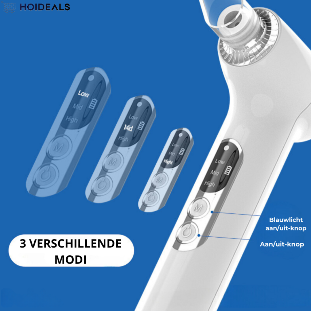 Verwijdering van tandsteen bij orthodontie | 70% Korting